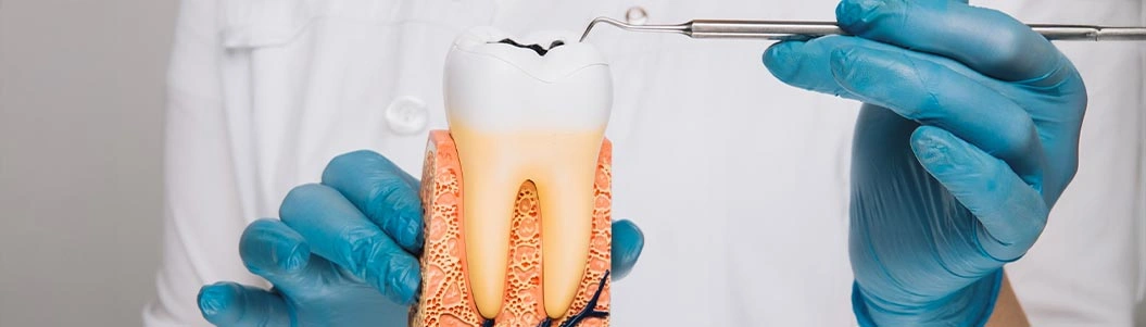 20'lik Diş Çekimi Sonrası İyileşme Süreci