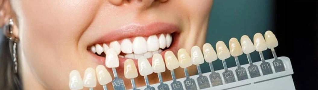 Kaplama Yapılan Dişlerde Neden Ağrı Olur?