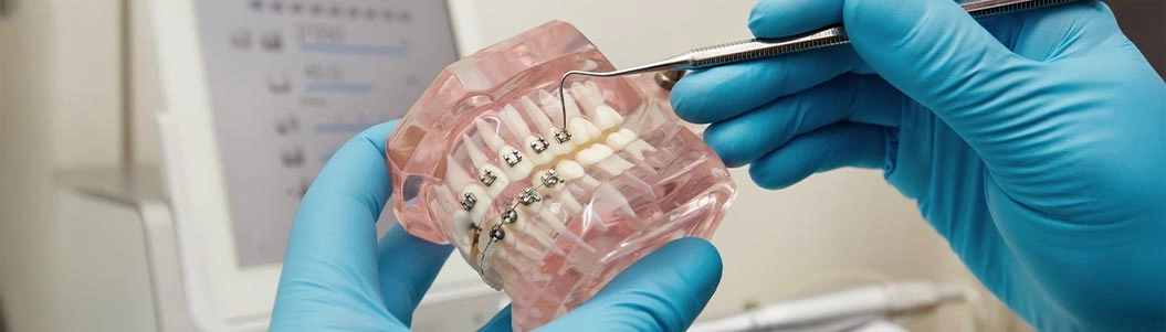 İzmir Çiğli Ortodonti- Çocuk diş Hekimi-Çocuk Ortodontik Tedavi