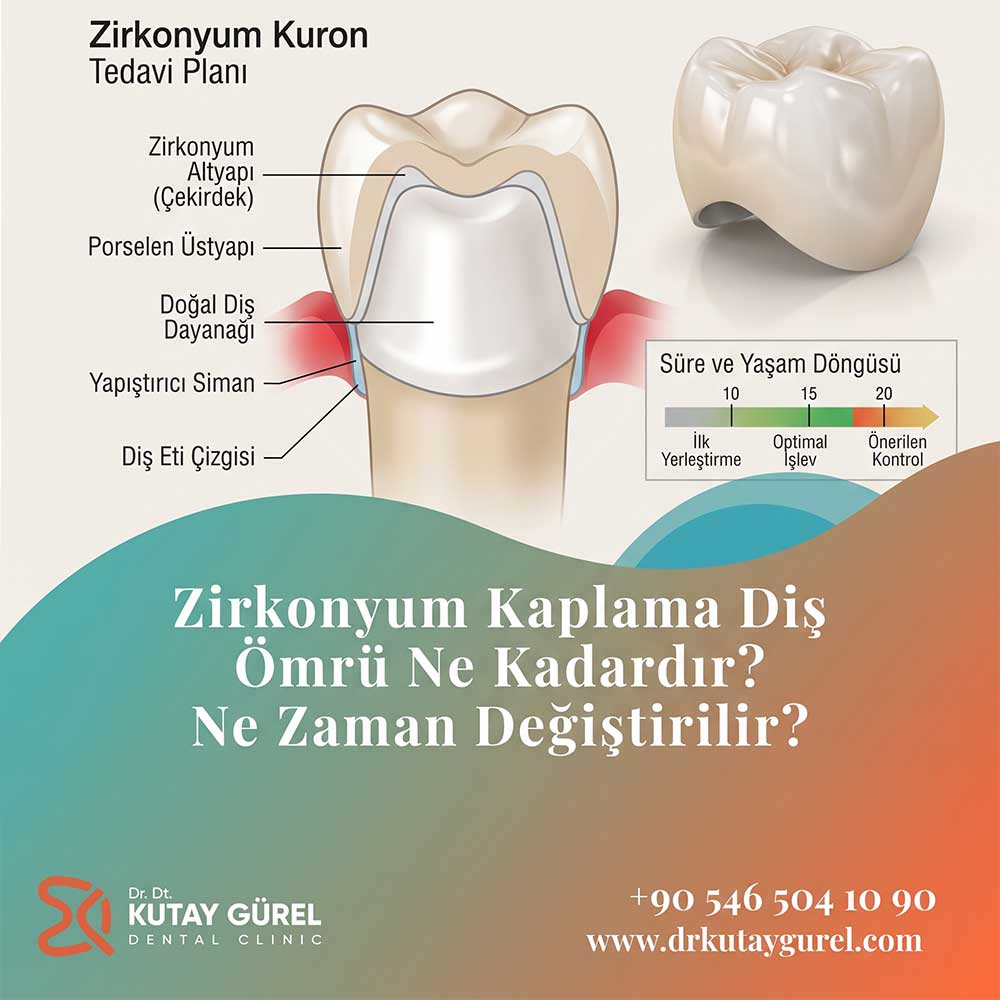 Zirkonyum Kaplama Diş Ömrü Ne Kadardır? Ne Zaman Değiştirilir?