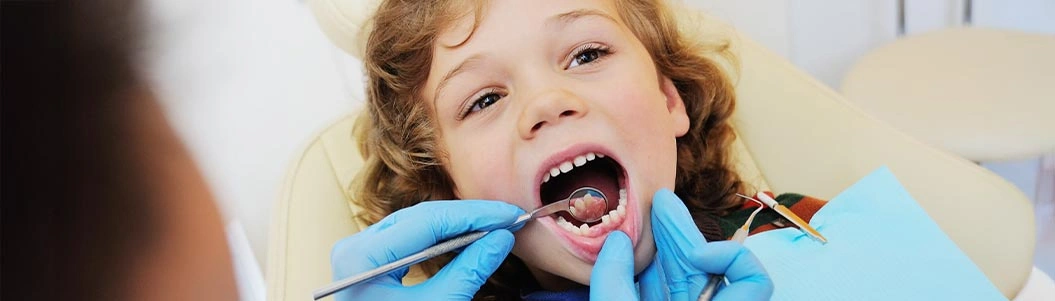 Ayrık Diş (Diastema) Nedir?