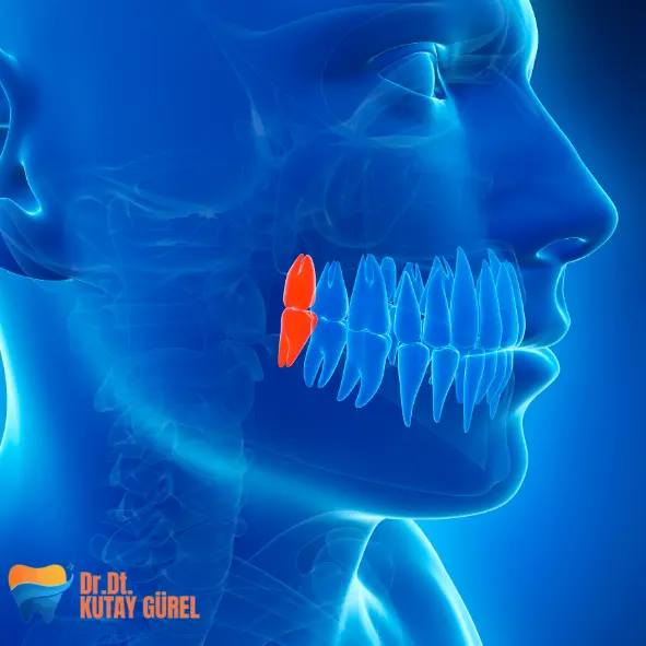 20'lik Diş Çekimi (Gömülü Diş Çekimi) - Sonrası- Ağrısı- Fiyatları İzmir