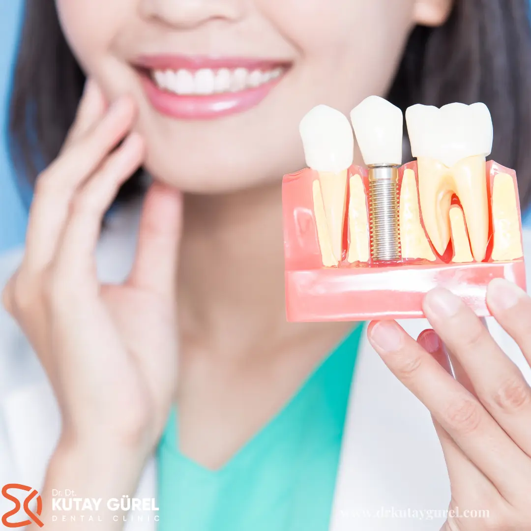 İzmir Çiğli'deki Dr. Dt. Kutay Gürel Diş Kliniği, All-on-4 Dental İmplant Tedavisi ile dişlerini kaybetmiş hastalara estetik ve fonksiyonel çözümler sunmaktadır. Bu tedavi, özellikle dişsiz çene yapısına sahip, kemik kaybı yaşayan veya diş protezi ihtiyacı duyan hastalar için idealdir. All-on-4 tedavisi, sabit diş protezleri ile kalıcı ve doğal görünümlü dişler sağlar.