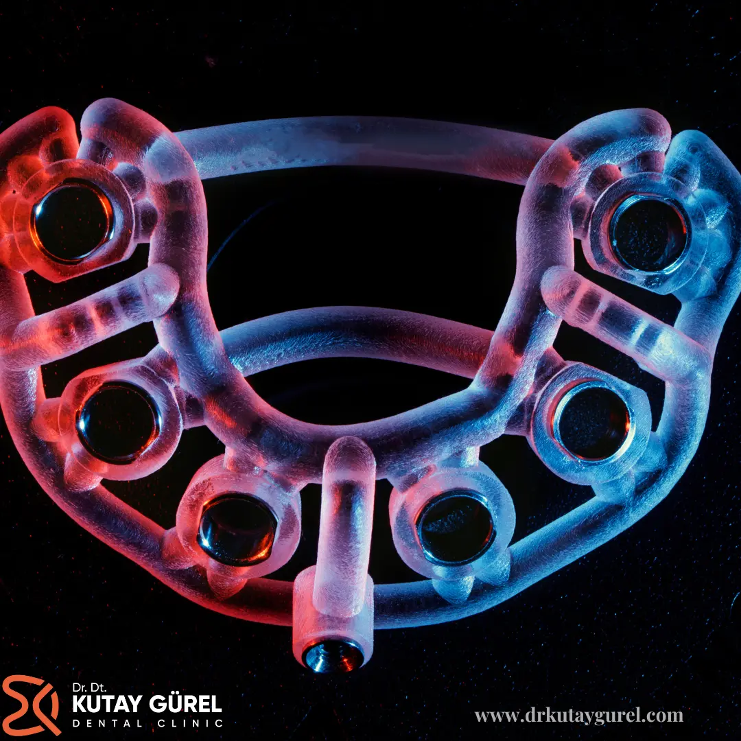 İzmir Çiğli All on Six Diş(Dental) İmplants Tedavisi, İzmir Çiğli Diş Doktoru Dr.Dt. Kutay Gürel, All-on-Six İmplants Dental, İzmir Çiğli En iyi diş doktoru