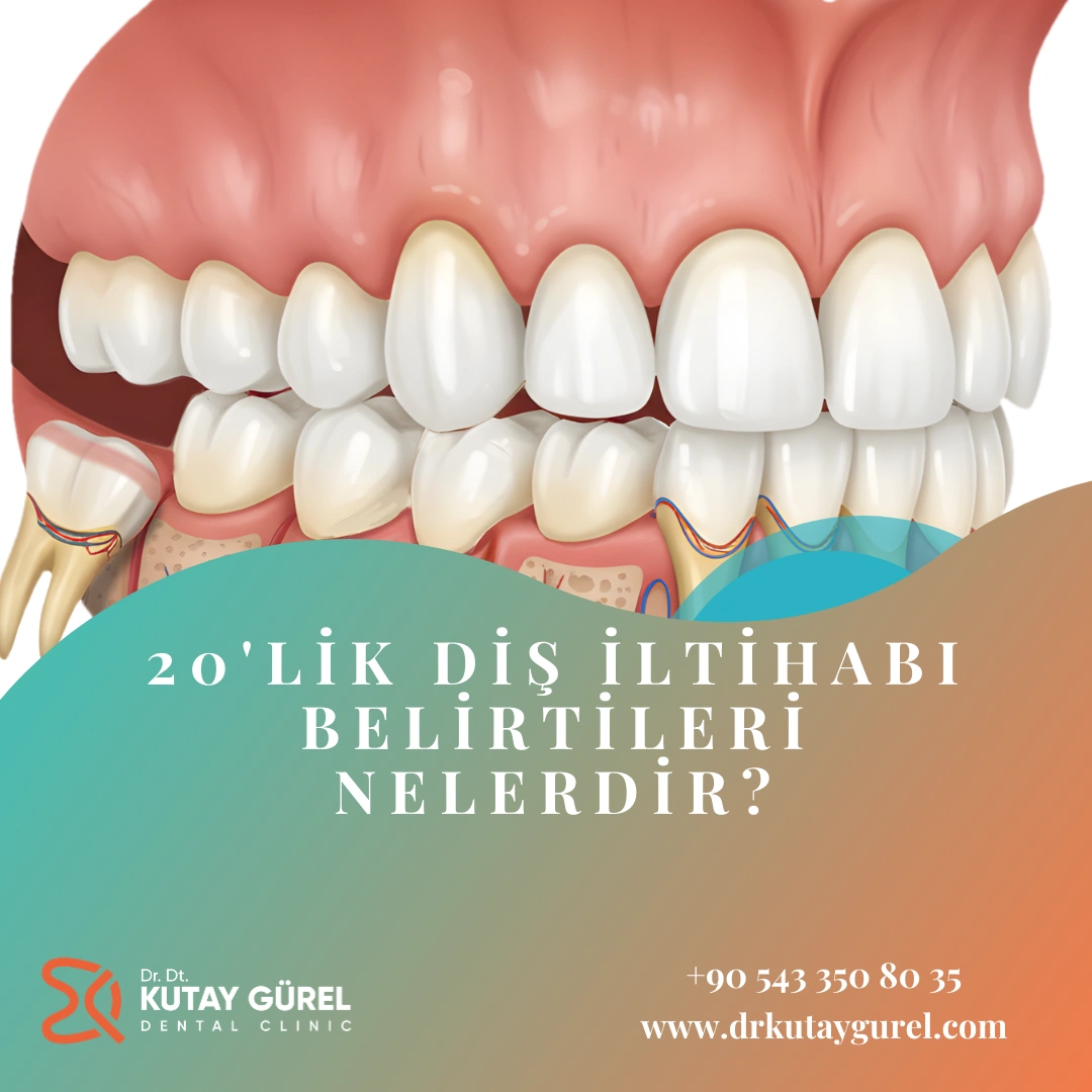  20 lik diş iltihabı belirtileri