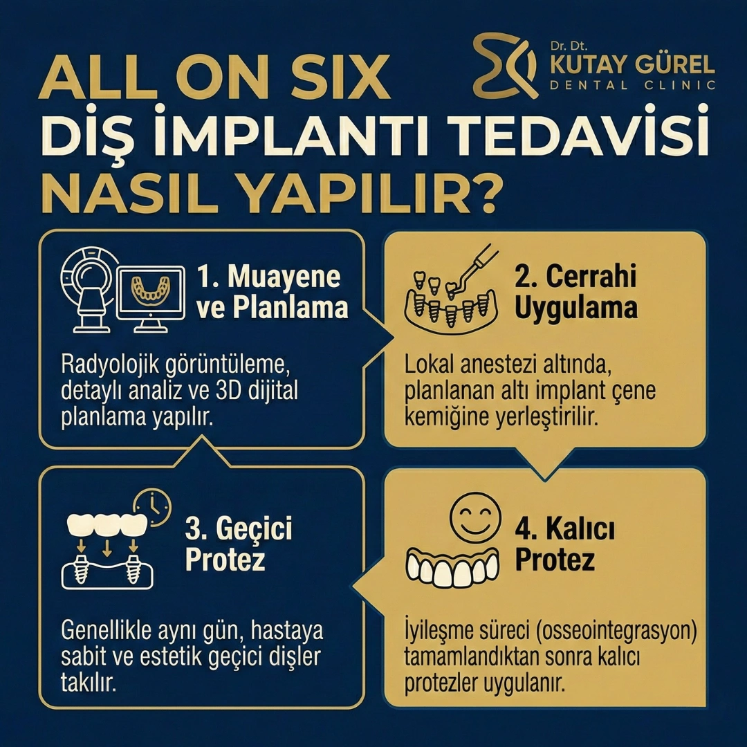 İzmir Çiğli All-on-Six İmplants Dental