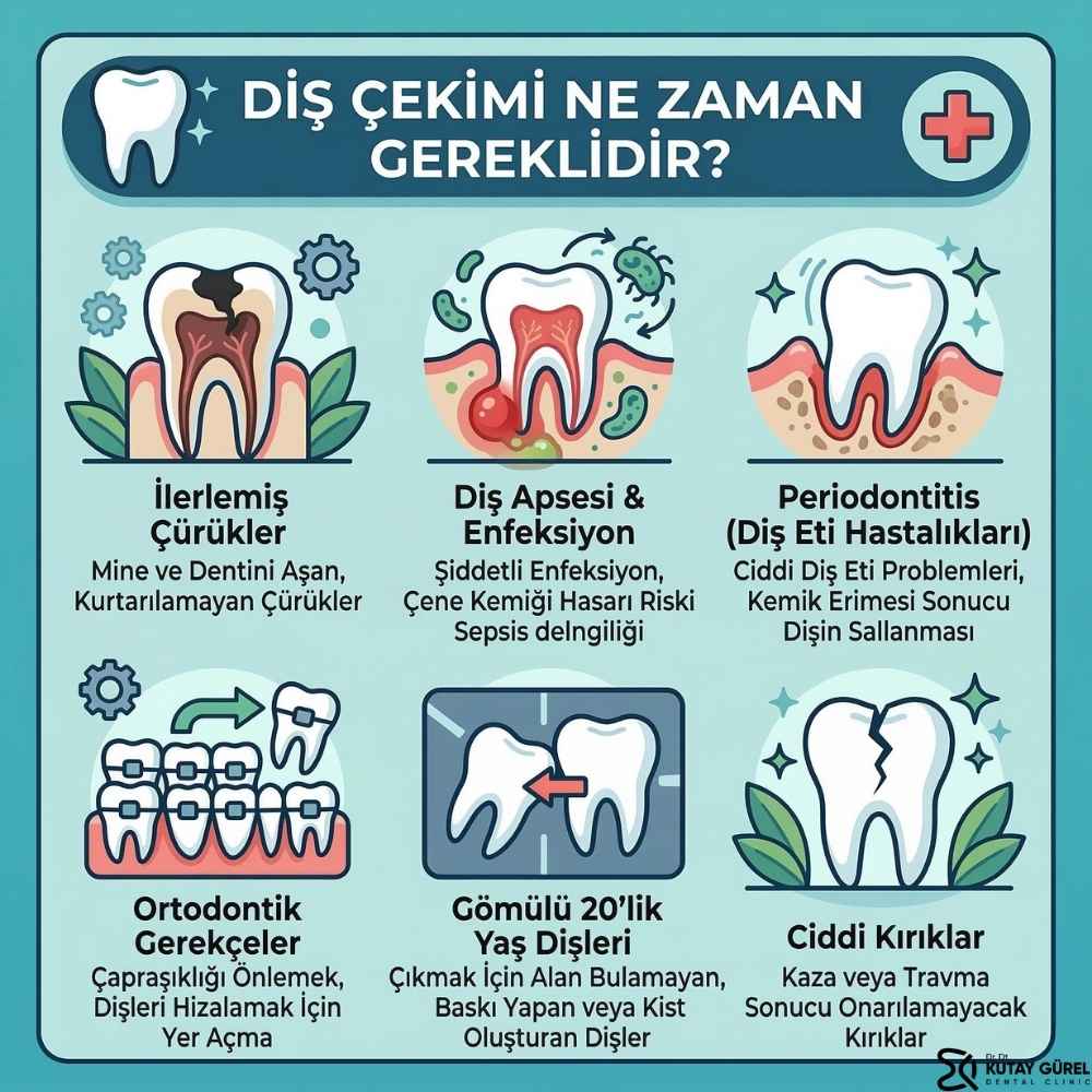 Gripken diş çekilir mi Kadınlar Kulübü