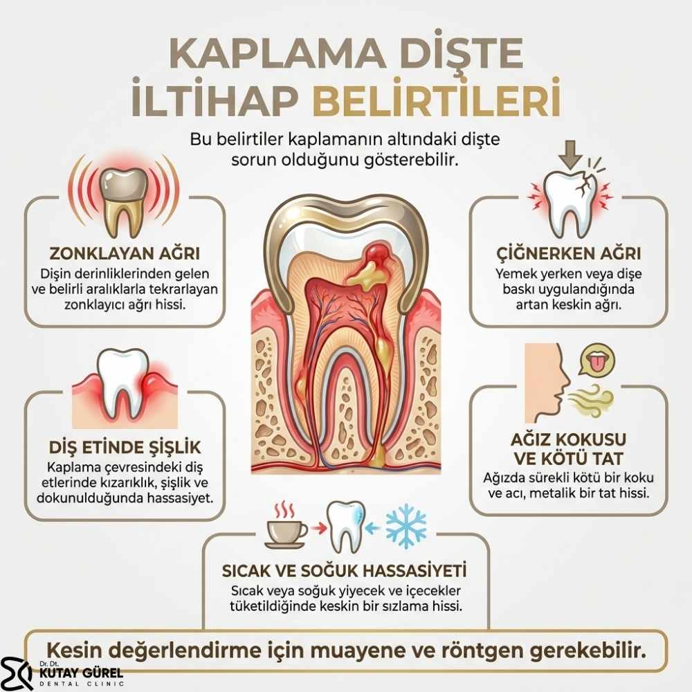 Kaplama Altındaki Dişin İltihaplanması Nasıl Geçer