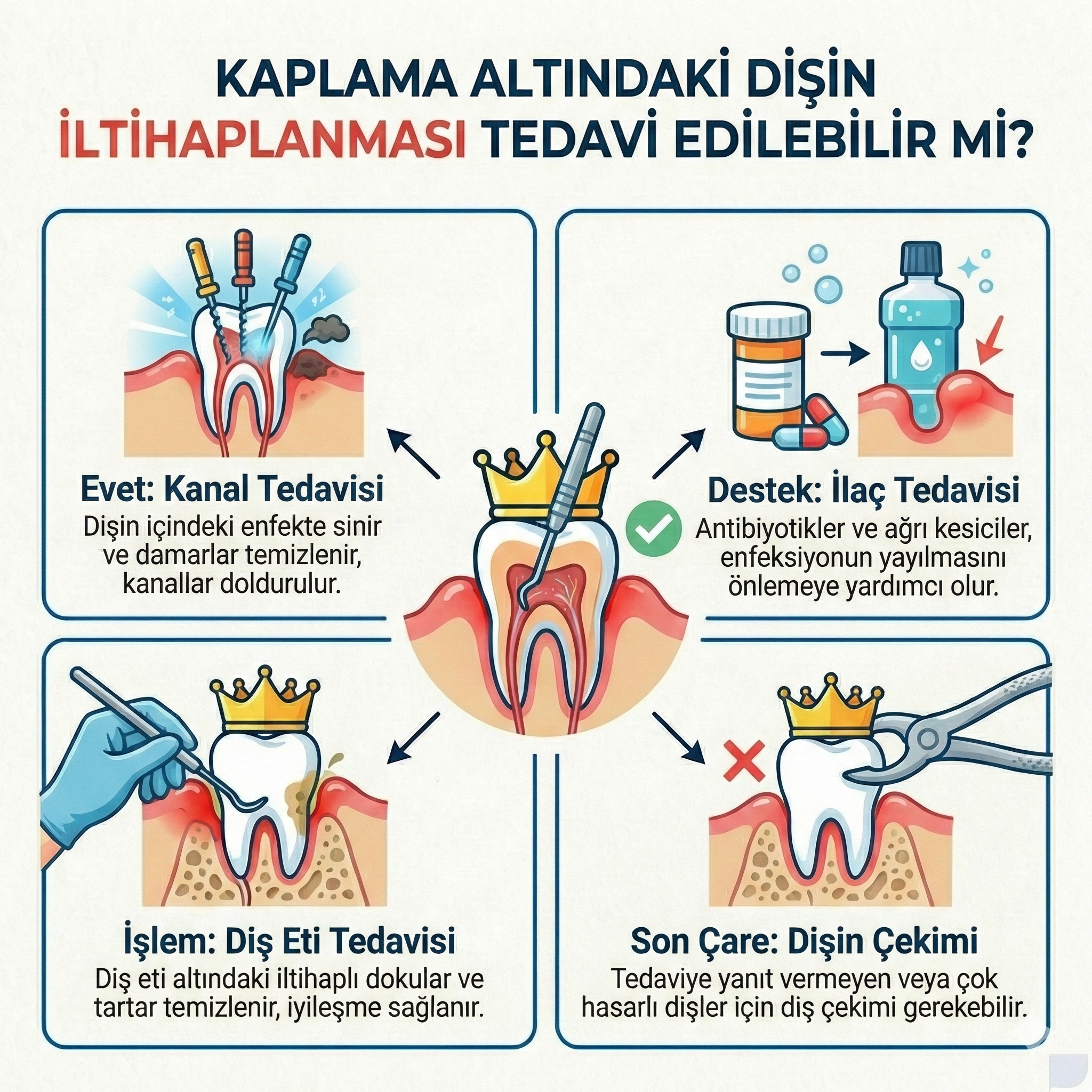 İzmir Çiğli En İyi Pediatrik Diş Hekimi Dr.Dt.Kutay Gürel Kaplama Altındaki Dişin İltihaplanması Tedavi Edilebilir mi