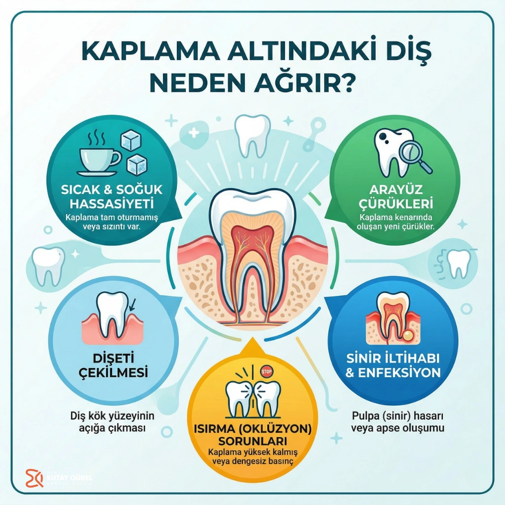 kaplamanın altındaki diş ağrısına ne iyi gelir