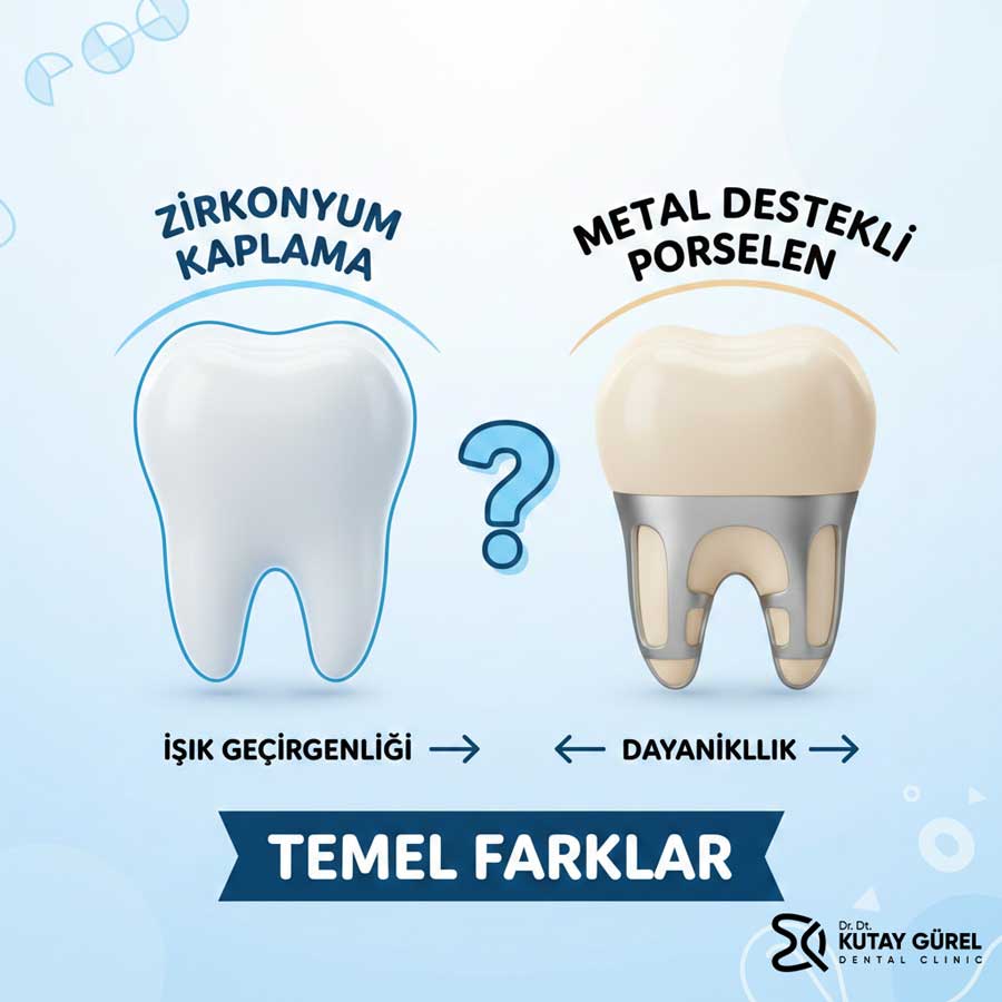 Zirkonyum Kaplama ile Metal Destekli Porselen Arasındaki Temel Farklar