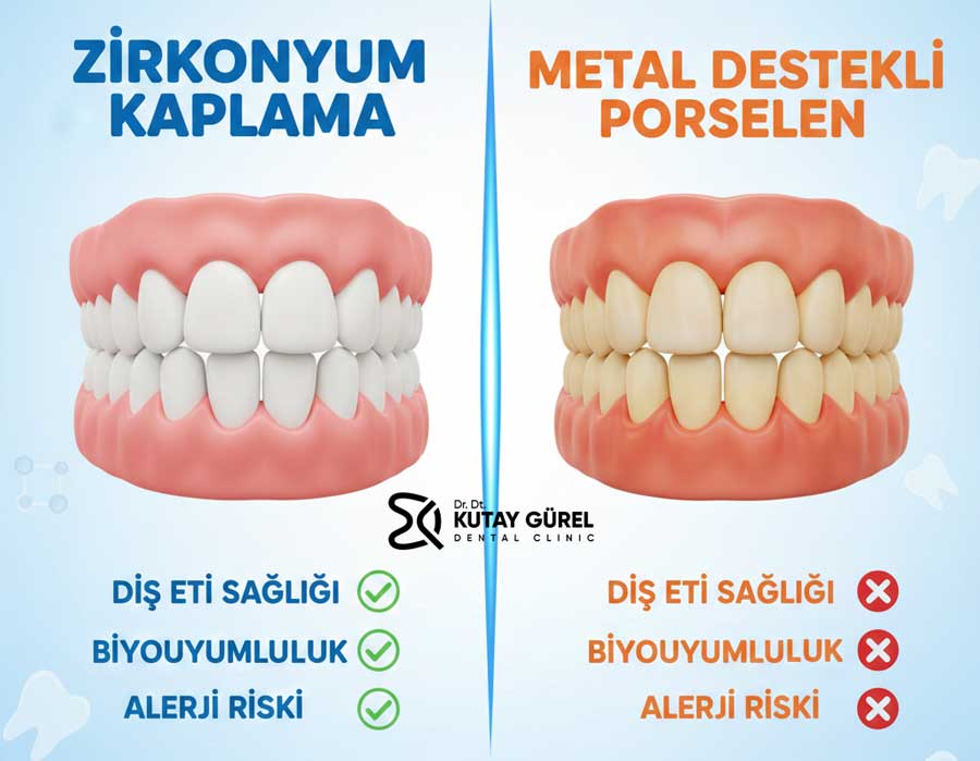 Zirkonyum Kaplamanın ve Metal Destekli Porselende Diş Eti Sağlığı