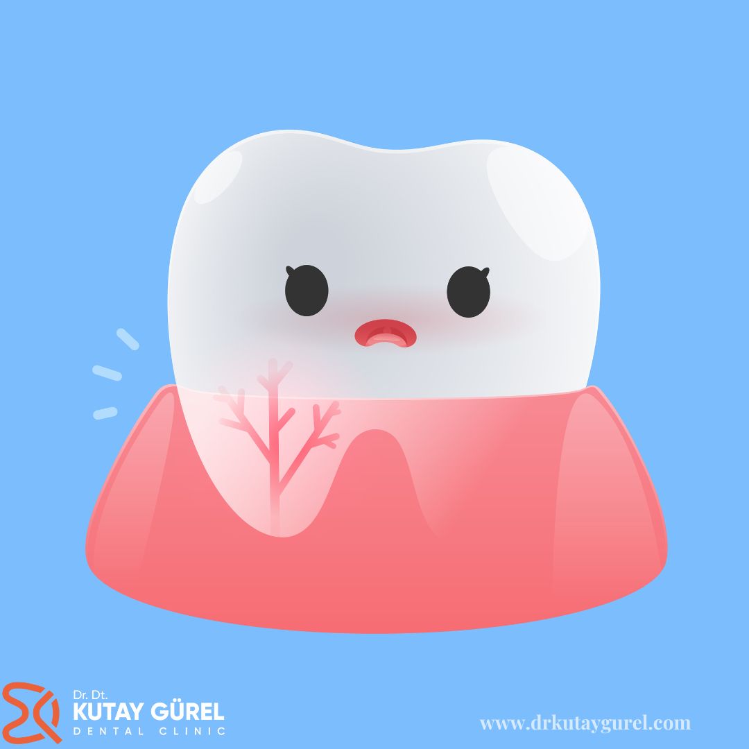 Çene Kemiğinde Kalan Diş Kökü