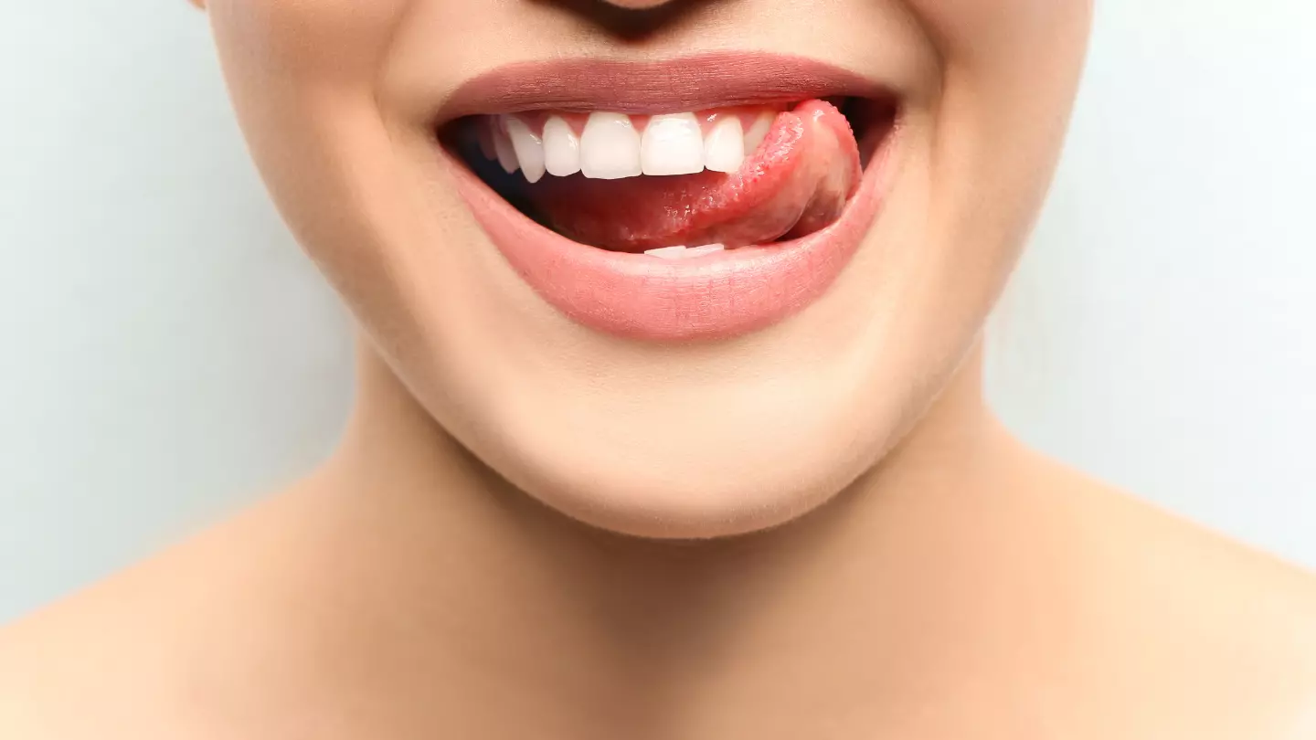 Diş Beyazlatıcısı izmir cigli - İzmir Çiğli en iyi diş doktoru Dr. Kutay Gürel tarafından yapılan lazer destekli diş beyazlatma işlemi ile hastanın daha beyaz ve estetik gülüş elde ettiği diş tedavisi fotoğrafı.