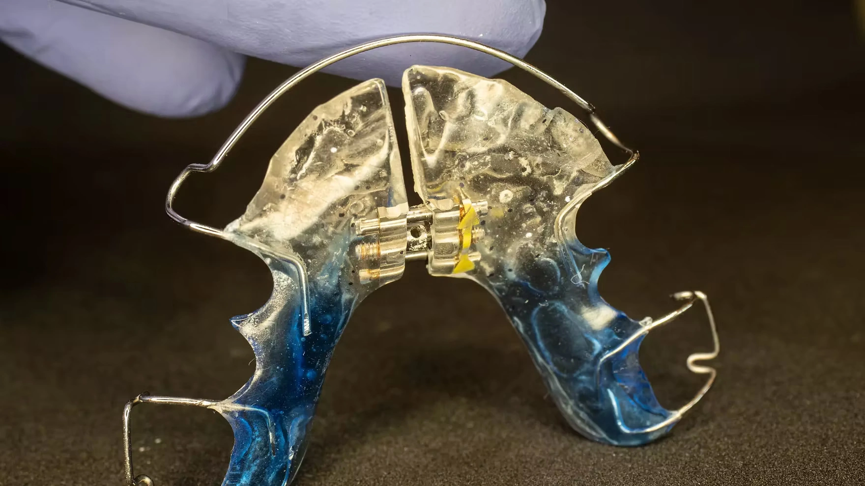 Ortodonti ve şeffaf plak tedavisi ile diş dizilimini düzelten, İzmir Çiğli’de hizmet veren uzman diş hekimi Dr. Kutay Gürel’in hasta değerlendirme ve tedavi planlama görüntüsü.