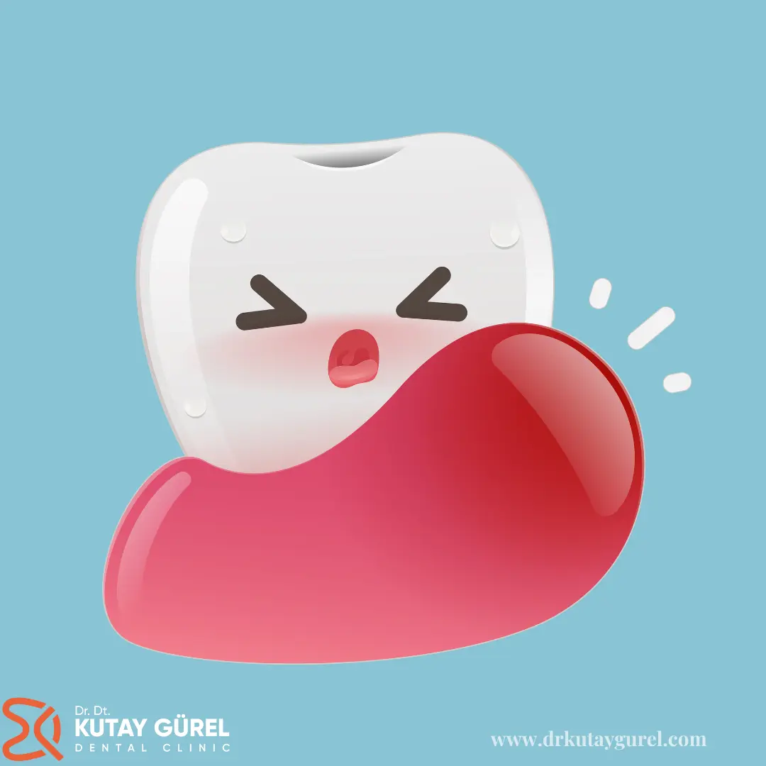 İzmir Çiğli En iyi diş doktoru Dr.Dt. Kutay Gürel Diş Kliniği üst damakta diş çıkması